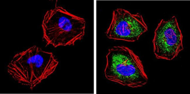 Cytokeratin Pan Antibody in Immunocytochemistry (ICC/IF)