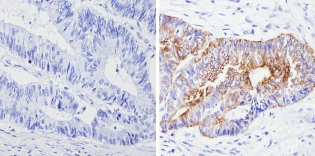 Cytokeratin Pan Antibody in Immunohistochemistry (Paraffin) (IHC (P))