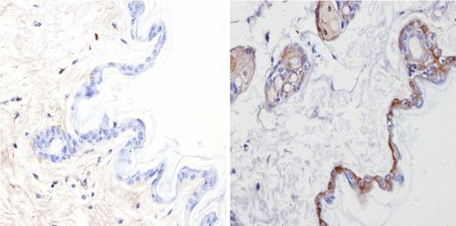 Cytokeratin Pan Antibody in Immunohistochemistry (Paraffin) (IHC (P))