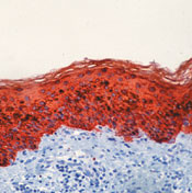 Cytokeratin Pan Antibody in Immunohistochemistry (Paraffin) (IHC (P))