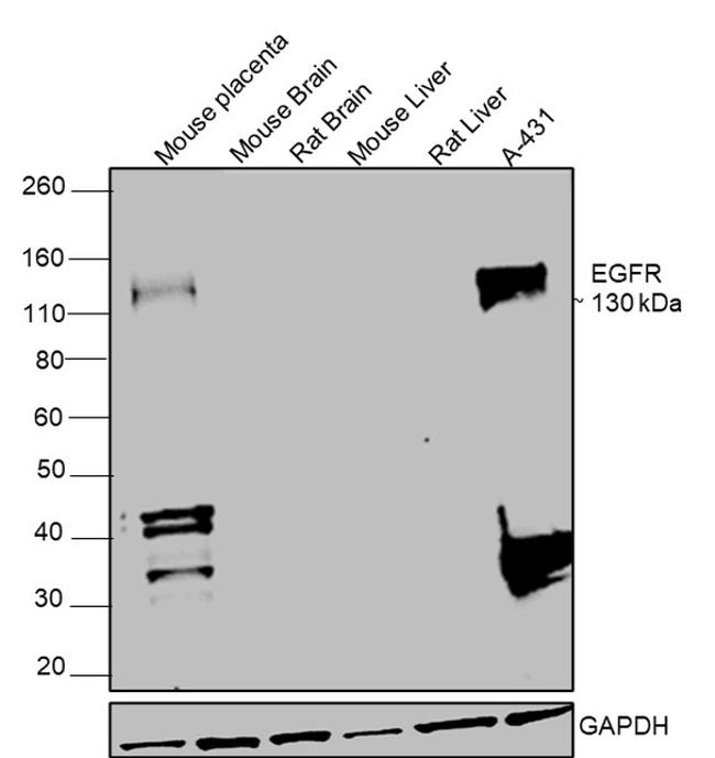 EGFR Antibody in Western Blot (WB)