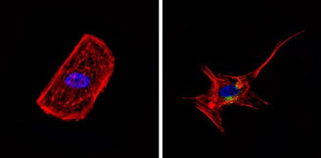 CD68 Antibody in Immunocytochemistry (ICC/IF)