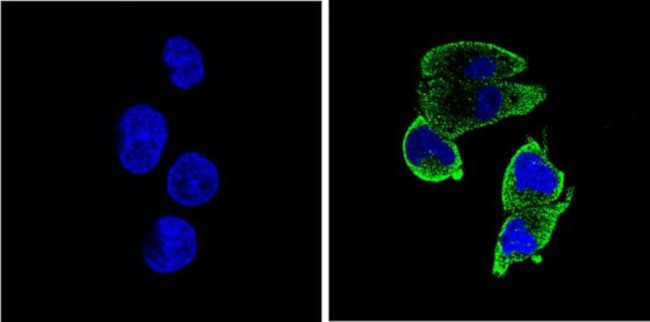 Thrombospondin 1 Antibody in Immunocytochemistry (ICC/IF)