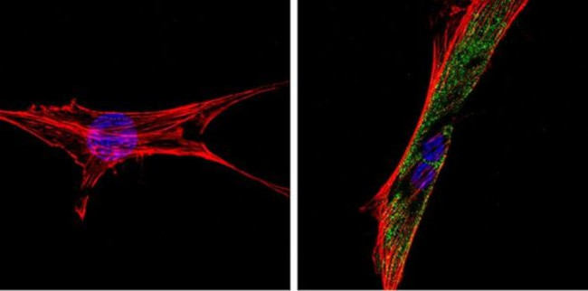 Thrombospondin 1 Antibody in Immunocytochemistry (ICC/IF)