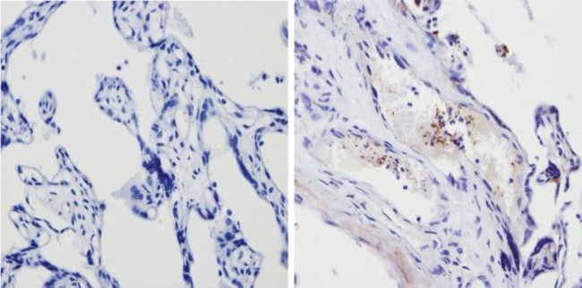 Thrombospondin 1 Antibody in Immunohistochemistry (Paraffin) (IHC (P))