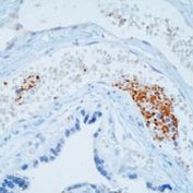 Thrombospondin 1 Antibody in Immunohistochemistry (Paraffin) (IHC (P))