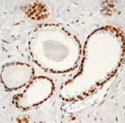 Androgen Receptor Antibody in Immunohistochemistry (Paraffin) (IHC (P))