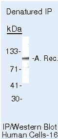 Androgen Receptor Antibody in Immunoprecipitation (IP)