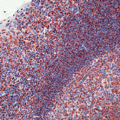 SNRPB Antibody in Immunohistochemistry (Paraffin) (IHC (P))