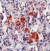 ACTH Antibody in Immunohistochemistry (Paraffin) (IHC (P))