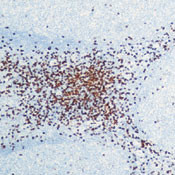 CD8 alpha Antibody in Immunohistochemistry (Paraffin) (IHC (P))