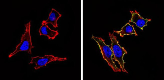 CD155 Antibody in Immunocytochemistry (ICC/IF)