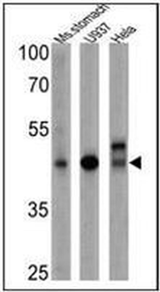 CD155 Antibody in Western Blot (WB)