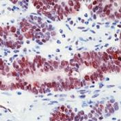 MGMT Antibody in Immunohistochemistry (Paraffin) (IHC (P))