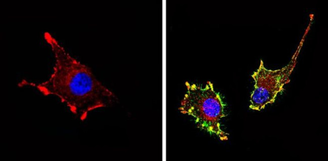 CD81 Antibody in Immunocytochemistry (ICC/IF)