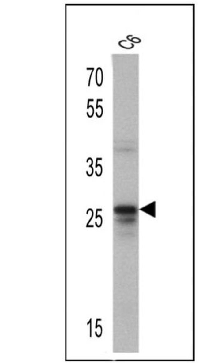 CD81 Antibody in Western Blot (WB)