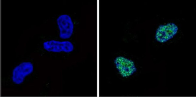 CBP Antibody in Immunocytochemistry (ICC/IF)