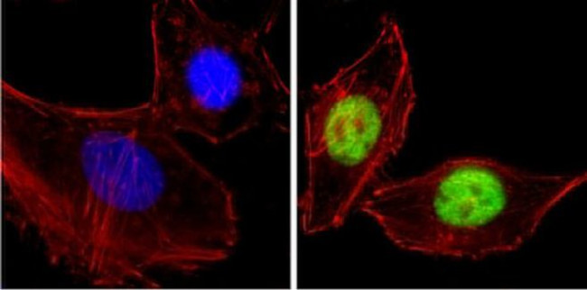 CBP Antibody in Immunocytochemistry (ICC/IF)