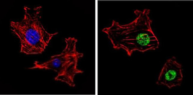 CBP Antibody in Immunocytochemistry (ICC/IF)