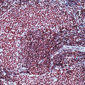 CBP Antibody in Immunohistochemistry (Paraffin) (IHC (P))