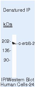 ErbB2 (HER-2) Antibody in Immunoprecipitation (IP)