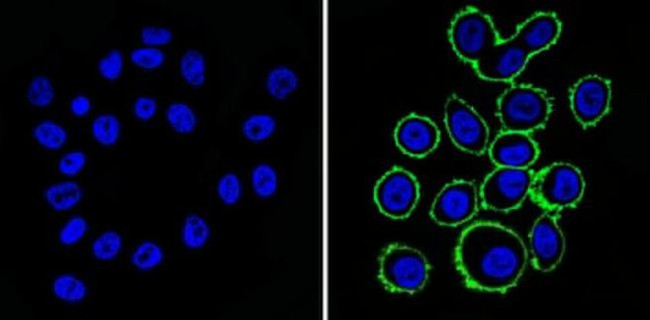 ErbB2 (HER-2) Antibody in Immunocytochemistry (ICC/IF)