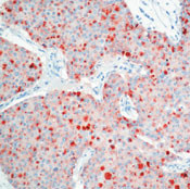 TIMP1 Antibody in Immunohistochemistry (Paraffin) (IHC (P))