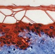 Cytokeratin 10 Antibody in Immunohistochemistry (Paraffin) (IHC (P))