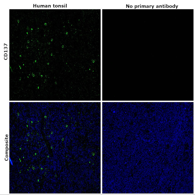 CD137 Antibody in Immunohistochemistry (Paraffin) (IHC (P))