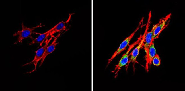 INSR beta Antibody in Immunocytochemistry (ICC/IF)