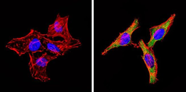 INSR beta Antibody in Immunocytochemistry (ICC/IF)