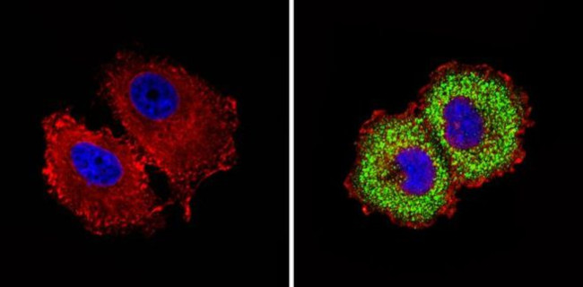 INSR beta Antibody in Immunocytochemistry (ICC/IF)