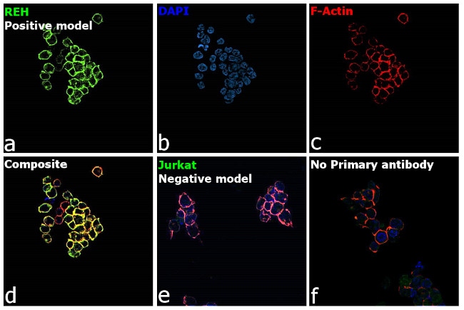 INSR Antibody in Immunocytochemistry (ICC/IF)