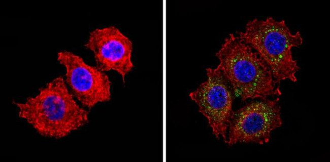 INSR Antibody in Immunocytochemistry (ICC/IF)