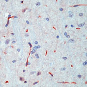 INSR Antibody in Immunohistochemistry (Paraffin) (IHC (P))