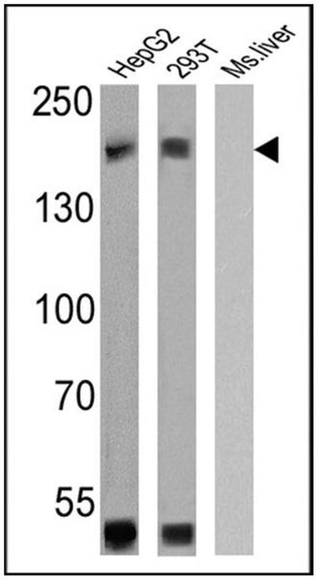 P-Glycoprotein Antibody in Western Blot (WB)