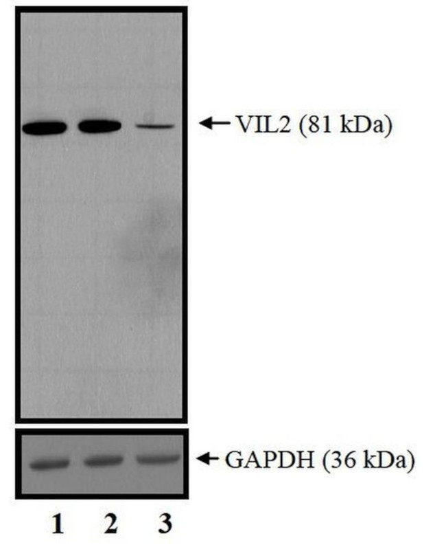 Ezrin Antibody