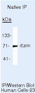 Ezrin Antibody in Immunoprecipitation (IP)