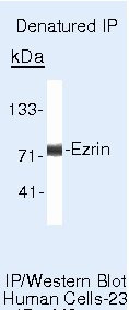 Ezrin Antibody in Immunoprecipitation (IP)