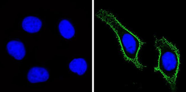 CD44 Antibody in Immunocytochemistry (ICC/IF)