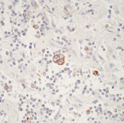 Bax Antibody in Immunohistochemistry (Paraffin) (IHC (P))