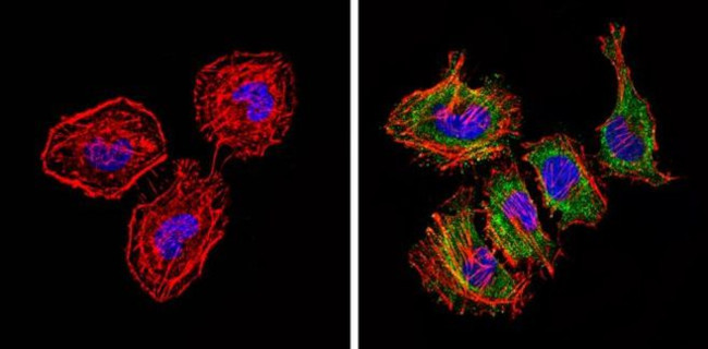 Bax Antibody in Immunocytochemistry (ICC/IF)