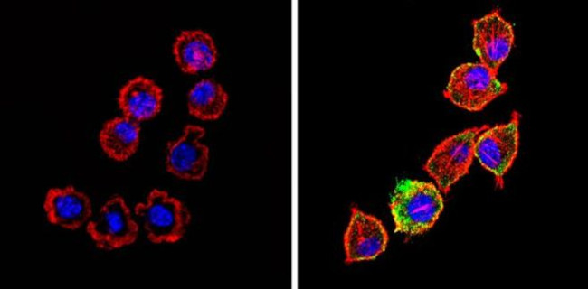 Bax Antibody in Immunocytochemistry (ICC/IF)