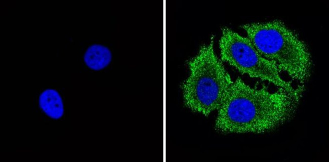 Bax Antibody in Immunocytochemistry (ICC/IF)