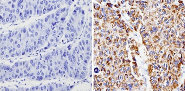 Bax Antibody in Immunohistochemistry (Paraffin) (IHC (P))