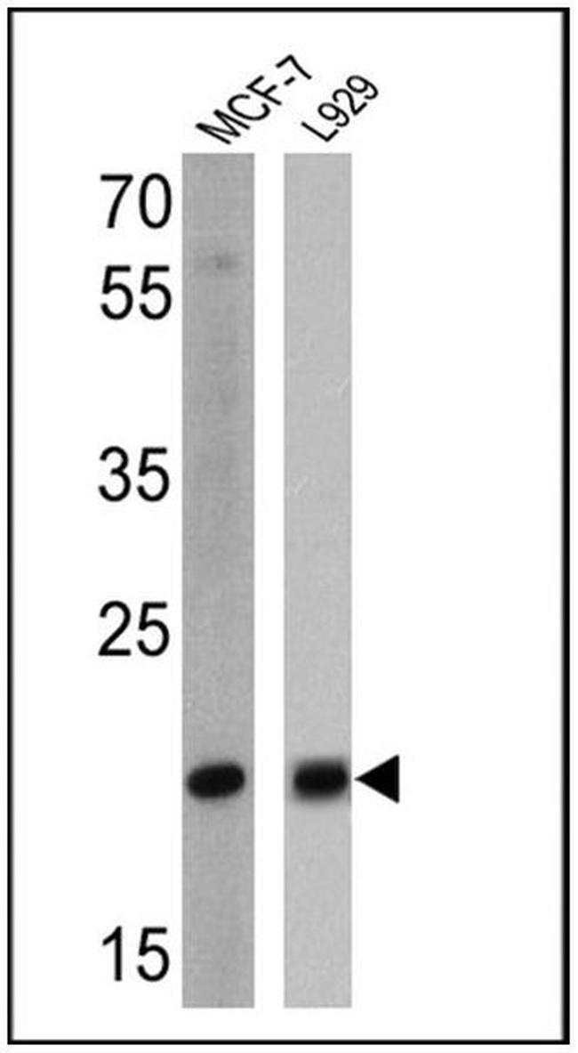 Bax Antibody in Western Blot (WB)