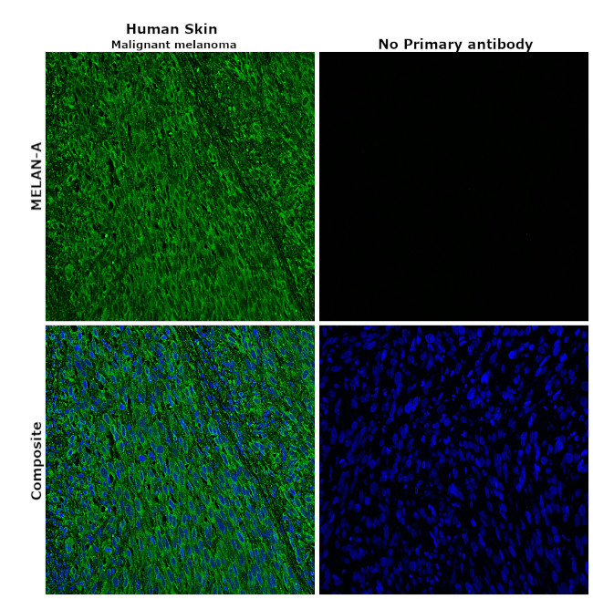 Melan-A Antibody in Immunohistochemistry (Paraffin) (IHC (P))