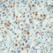 Cyclin E Antibody in Immunohistochemistry (Paraffin) (IHC (P))