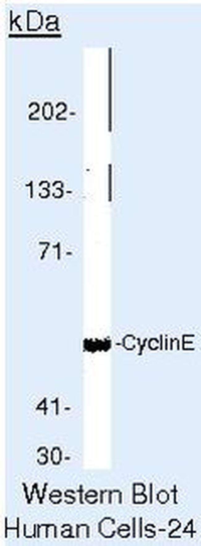 Cyclin E Antibody in Western Blot (WB)