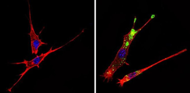 c-Abl Antibody in Immunocytochemistry (ICC/IF)